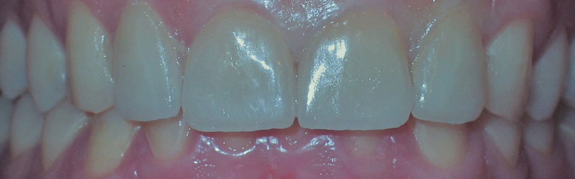 banner aesthetic restoration