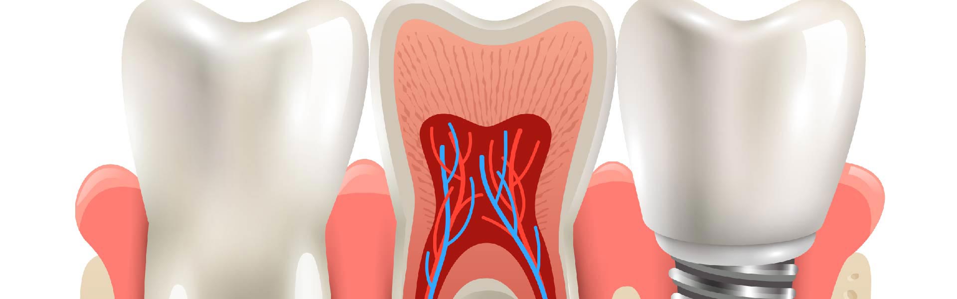 banner dentistry