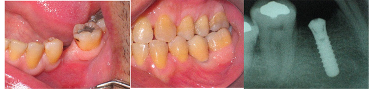 emfiteumata 1