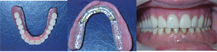 emfiteumata 2