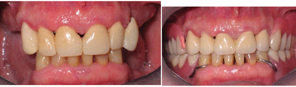 merikes odontostoixies