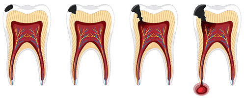 odontotherapeia