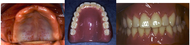 olikes odontostoixies